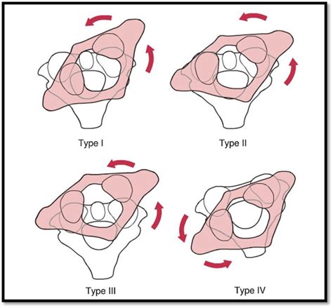 C1 C2 Subluxation Treatment - Pregnant Center Informations