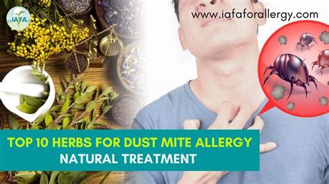 Top Dust Allergy, Rhinitis Homeopathic Medicines-Doctor, 43% OFF