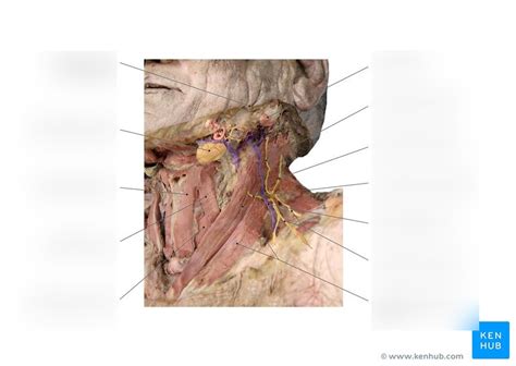 Gross Anatomy Lab Exam 2 - Neck muscles cadaver Diagram | Quizlet