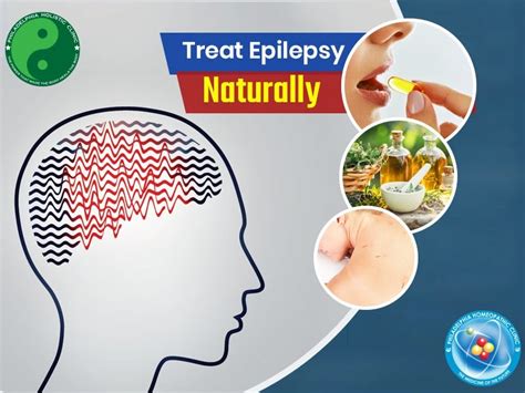 Best Natural Remedies for Epilepsy