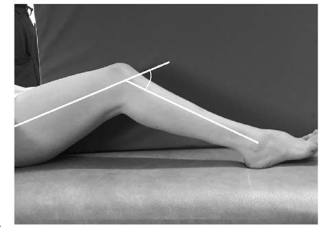 Examination position of knee flexion contracture. By using a goniometer... | Download Scientific ...