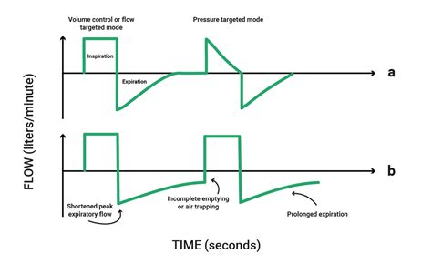 Ventilator Graphics Made Easy