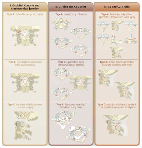 Subaxial Cervical Spine Injury Classification