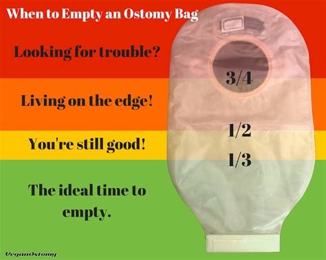 8 Ostomy Leak Prevention Tips | Ostomy Belts | Stealth Belt