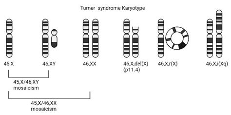 JCDD | Free Full-Text | A Review of Recent Developments in Turner ...