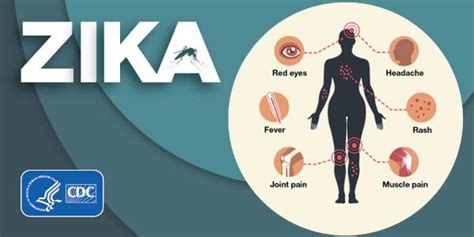 Symptoms | Zika virus | CDC