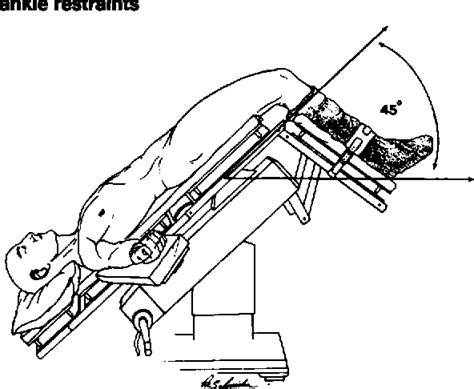 [PDF] The Trendelenburg position: a review of current slants about head down tilt. | Semantic ...