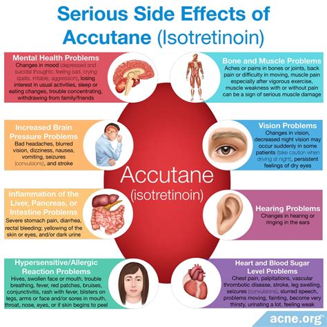 Does Taking Oral Isotretinoin Cause the Skin to Age Faster? - Acne.org