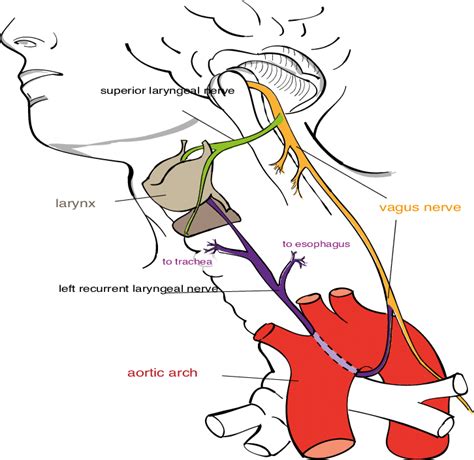 Vagus Nerve Palsy