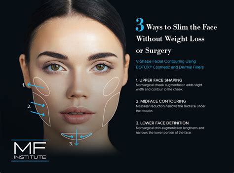 Forget Buccal Fat Removal: Start With BOTOX® for Face Slimming (Updated ...