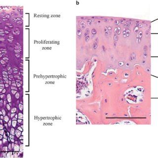 Role of Wnts and Wnt-related molecules in cartilage development Role in ...