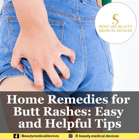 Home Remedies for Butt Rashes: Easy and Helpful Tips