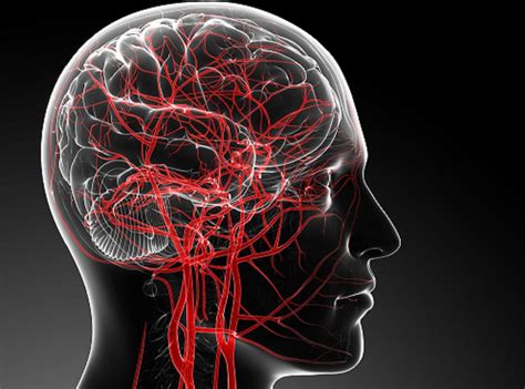 Risk of Acute Ischemic Stroke in Brain Tumor Survivors - Oncology Nurse ...