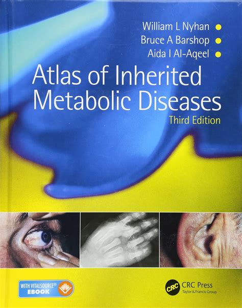 Buy ATLAS OF INHERITED METABOLIC DISEASES 3ED (HB 2012) Book Online at Low Prices in India ...