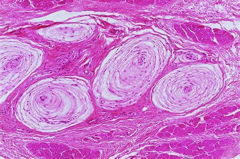 Pacinian Corpuscles Photograph by Innerspace Imaging/science Photo Library