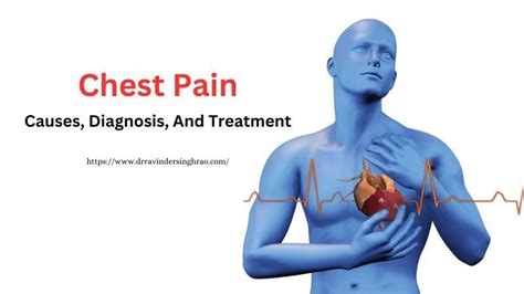 Chest Pain – Causes, Diagnosis, And Treatment by Dr Ravinder Singh Rao ...