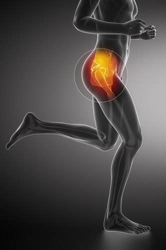 GREATER TROCHANTERIC PAIN SYNDROME :CUASES&TREATMENT