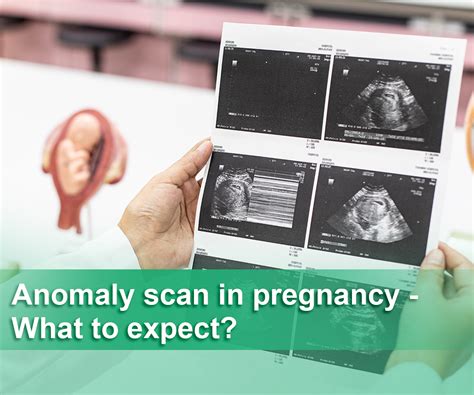 Anomaly Scan in Pregnancy - What to expect?