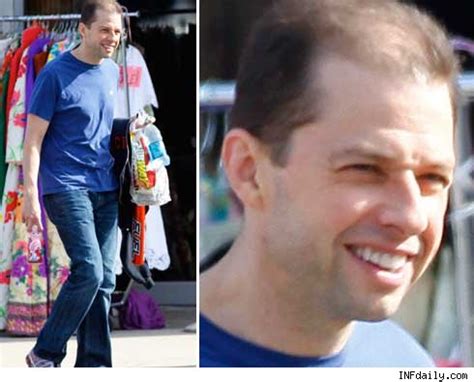 Balding Celebrities!!: Jon Cryer