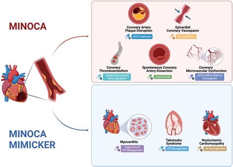 Frontiers | Myocardial infarction with non-obstructive coronary ...