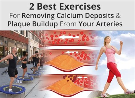 How To Unclog Arteries With Exercise – Online degrees