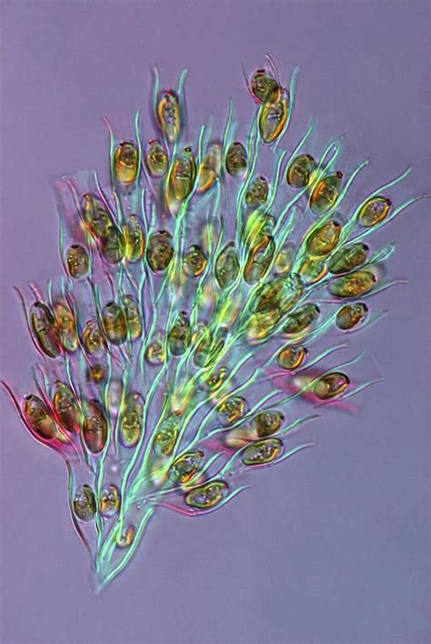 Golden algae, light micrograph Photograph by Science Photo Library - Pixels