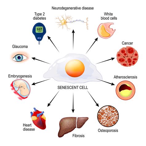 What Causes Accelerated Aging? Research on Senescent Cells - Natural ...