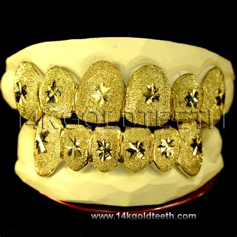 Top & Bottom Yellow Gold Teeth Grillz - TBY 30005