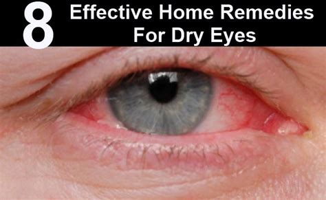 8 Effective Home Remedies For Dry Eyes | Dry eyes, Home remedies, Remedies