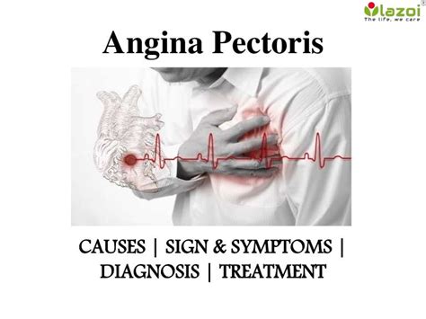 Angina pectoris : causes, symptoms, diagnosis and treatment