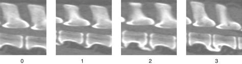 Is Spondylosis In Dogs Hereditary