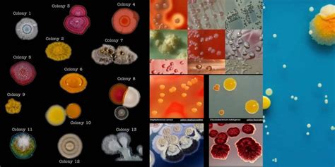 Colony Morphology Of Bacteria And Examples F8C | Bacteria, Morphology ...