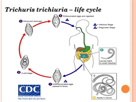 TRICHURIS TRICHIURA Diagram | Quizlet