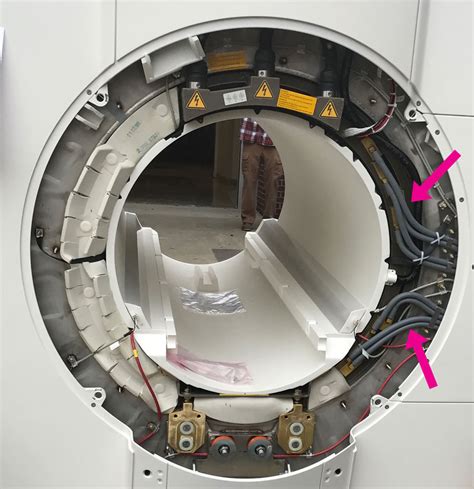 Gradient heating - Questions and Answers in MRI