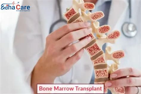 Bone Marrow Transplant - Risks, Benefits, Procedure