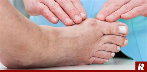 The Best Explanation for Hallux Rigidus (Pain & Stiffness In Big Toe ...