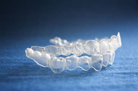 Clear Aligners | Teeth Straightening | Diamond Coast Dental