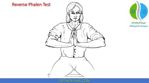 Phalen & Reverse Phalen Test | OrthoFixar 2024