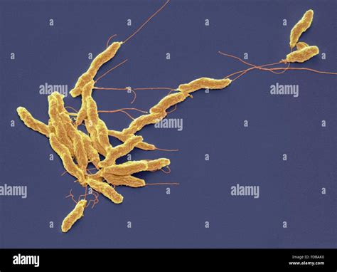 Shigella bacteria sem hi-res stock photography and images - Alamy