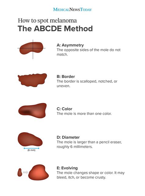 Signs Of Skin Cancer Arm