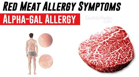 Red Meat Allergy Symptoms - Alpha-gal Allergy - Getinfopedia.com