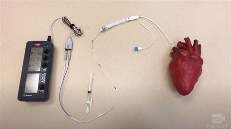 Transvenous pacemaker placement and troubleshooting - County EM