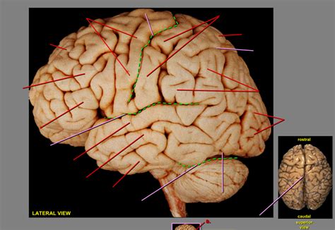 External Gyri and Sulci Diagram | Quizlet