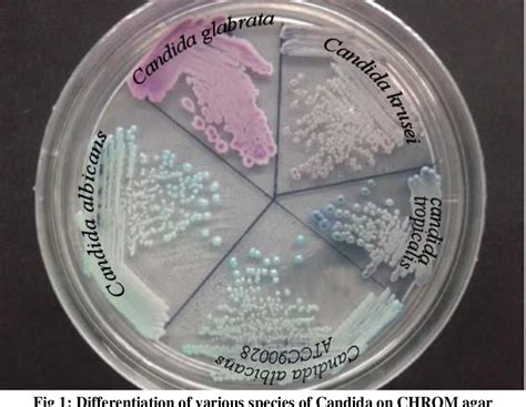 Figure 1 from USE OF CHROMOGENIC MEDIUM FOR SPECIATION OF CANDIDA ...