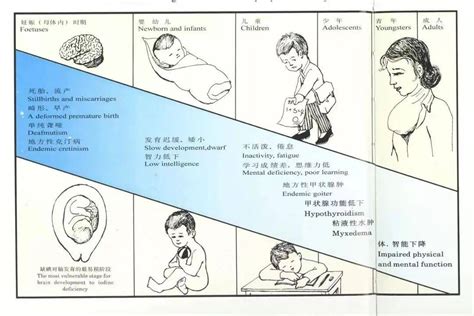 全国防治碘缺乏病日来临，这些知识要知道_危害_儿童_水源