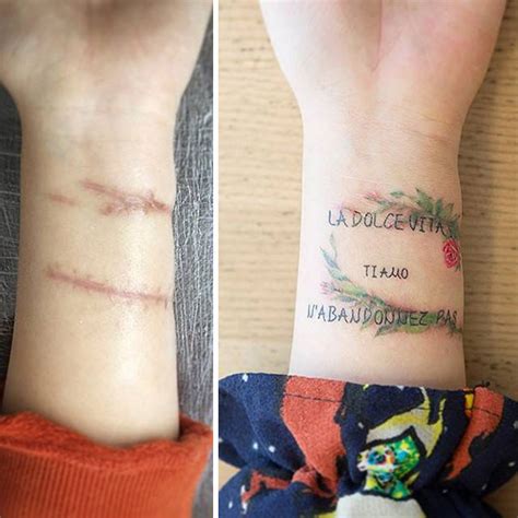 10+ Amazing Tattoos That Turn Scars Into Works Of Art | Bored Panda