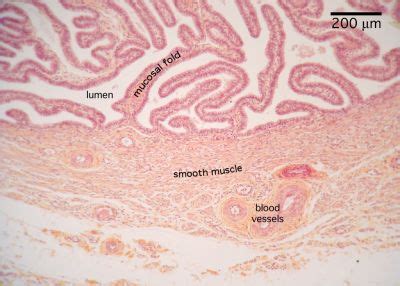 Oviduct Histology - Oviduct (labels) - histology slide