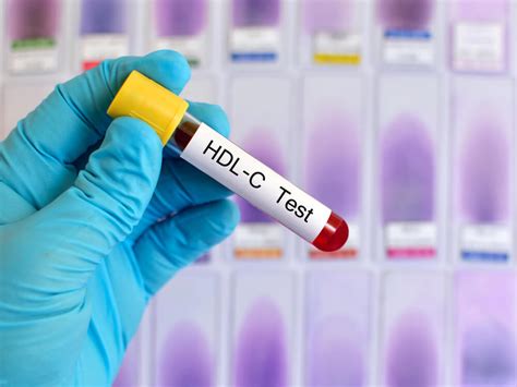 HDL CHOLESTEROL TEST