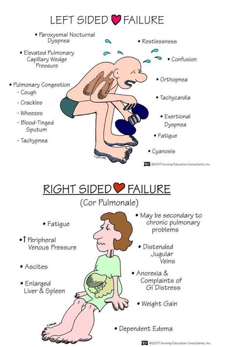 Cardiac Failure | Nursing students, Nursing school survival, Pharmacology nursing