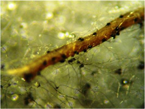 Pycnidial Macrophomina phaseolina structures (100-200 µm) of fungi on ...